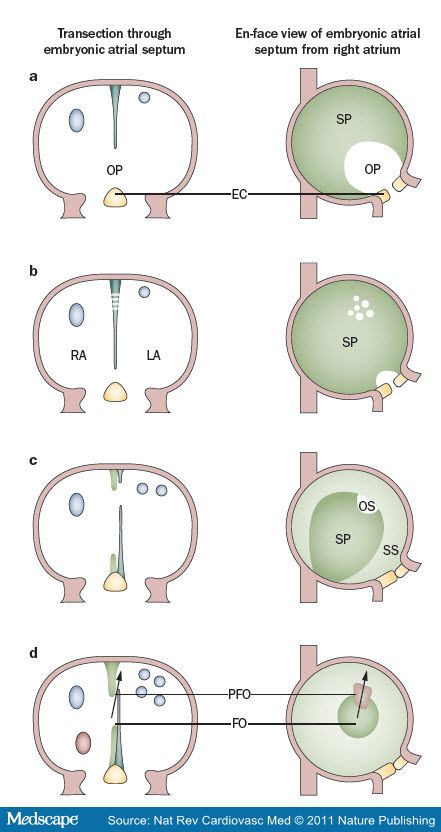 ASD-process.jpeg